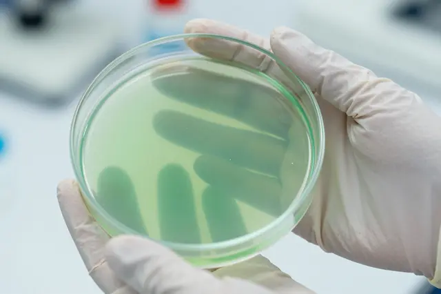 Close-up of gloved lab hands holding a glass petri dish with pale green liquid medium