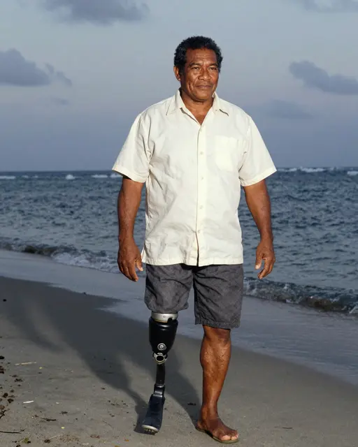 Pacific Islander man in his fifties with a prosthetic leg stands on a sandy beach at dusk beside the ocean