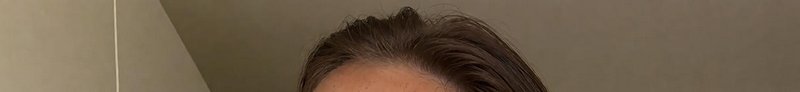 Close up view of a receding dark brown hairline against a plain beige indoor wall