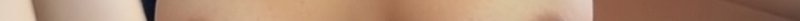 Close-up of a person’s bare upper torso/neck area with warm skin tones.