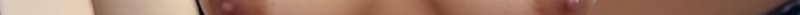 Close-up of a small portion of bare skin with a nipple partially visible