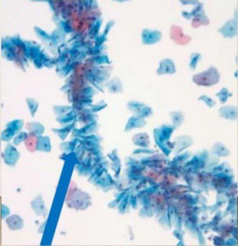 Abstract blue leaf and feather textures on a white background with a bold blue diagonal line.