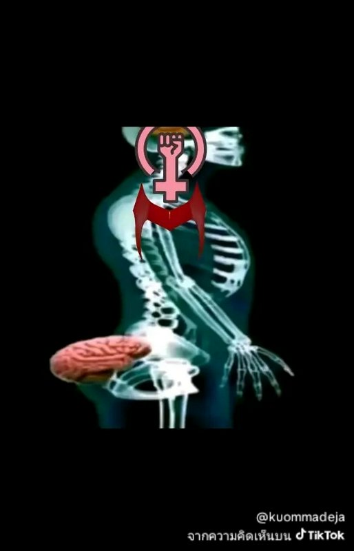 X-ray side view of a human skeleton with brain and heart exposed, overlaid by a feminist symbol a...