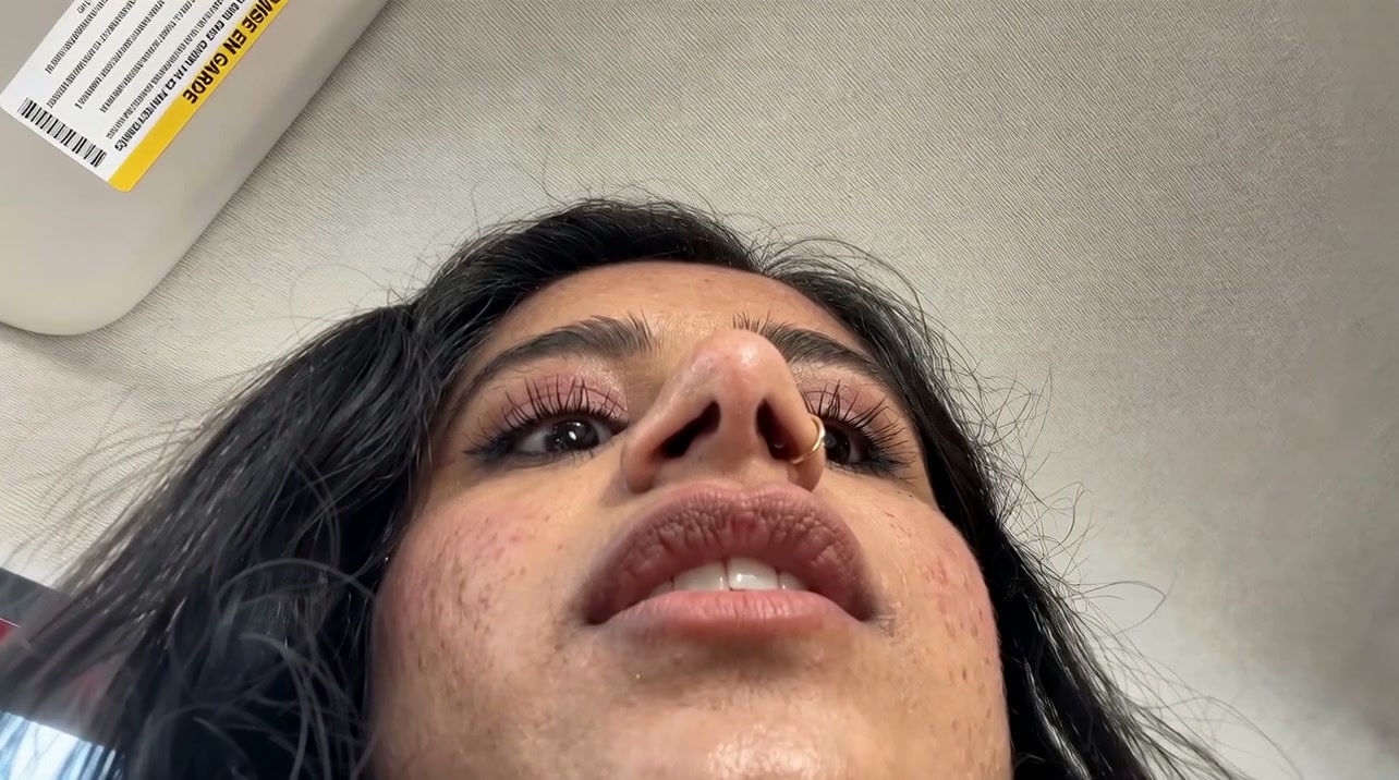 Close-up of a young woman looking up, featuring a septum nose ring and acne on the cheeks.