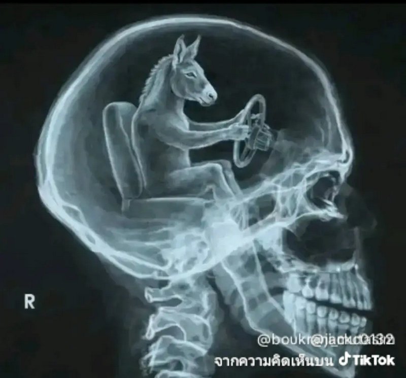 X-ray side view of a human skull with a cartoon horse driving a car inside the head.