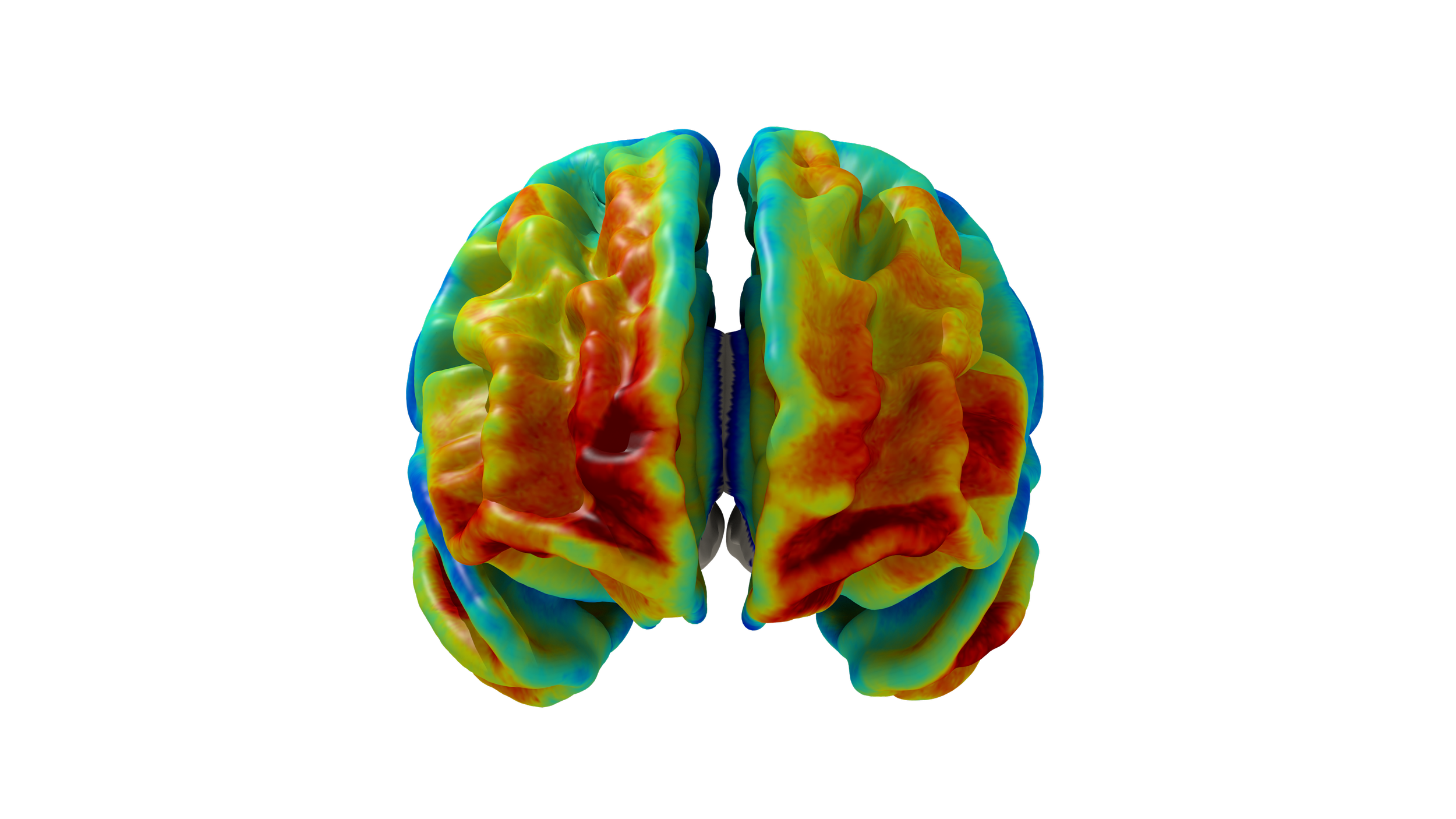 Colorful 3D brain heat map visualization viewed from above against a black background