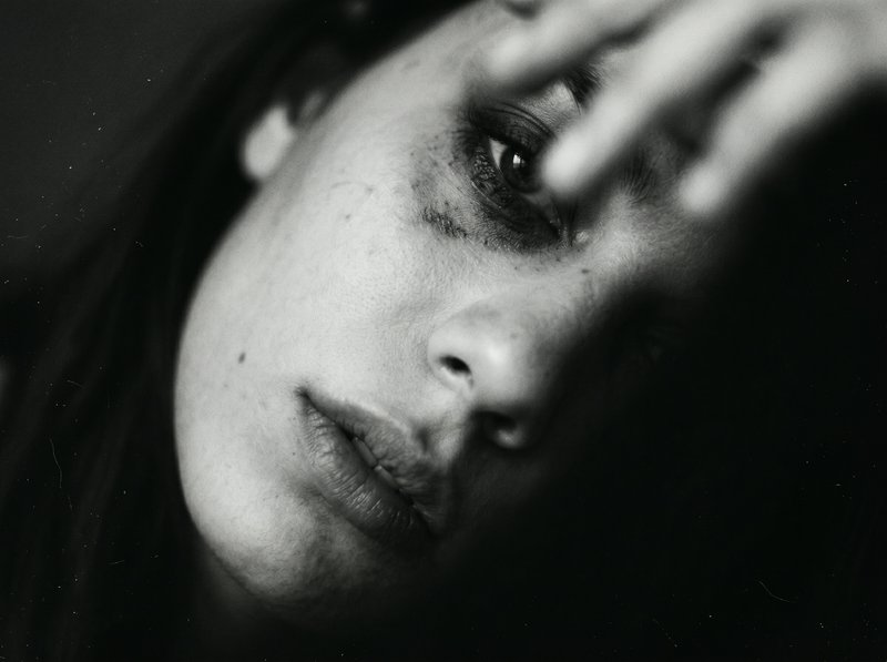 Close-up black-and-white portrait of a woman with a bruised eye and intense gaze.